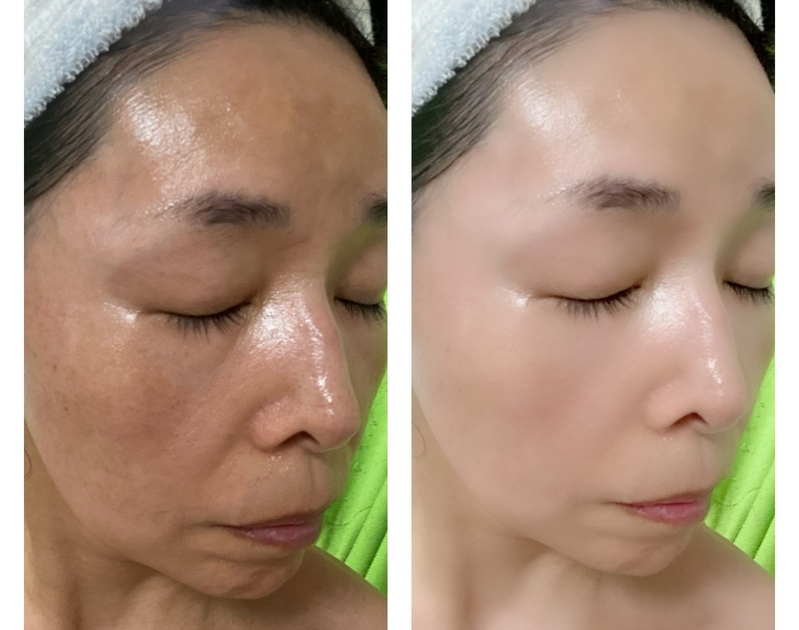 ご利用者の写真