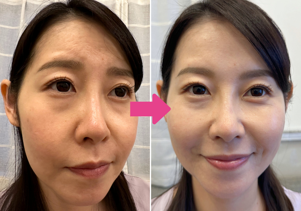 ご利用者の写真